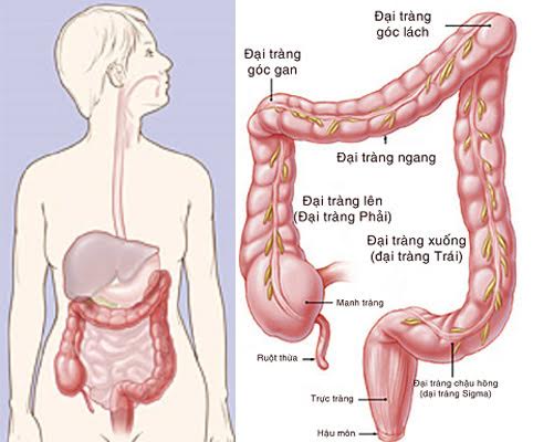 Hội chứng ruột kích thích